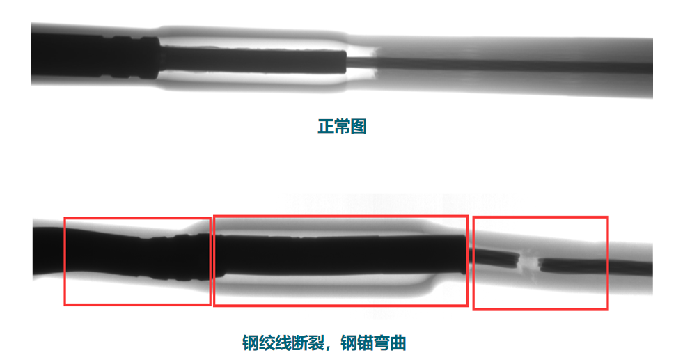 DR数字成像检测技术输电应用案例—液压型耐张线夹-